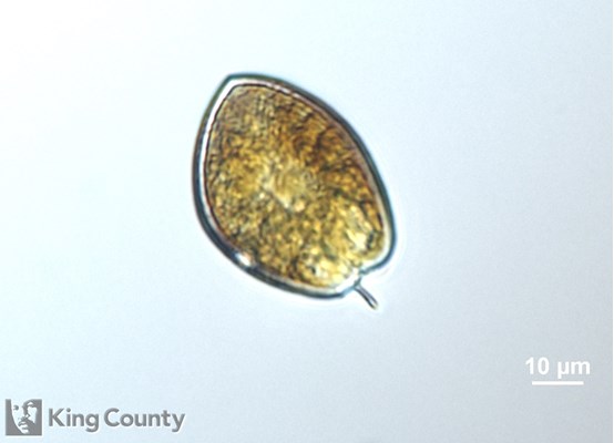 Photo of Prorocentrum micans